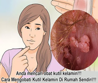Obat oles kutil kelamin alami, obat penyembuh kutil kelamin atau kutil di kemaluan, nama obat kutil kemaluan di apotik, cara efektif menghilangkan kutil kelamin, gambar kutil kelamin atau kutil di kemaluan pada wanita, obat kutil kelamin yang paling manjur, kutil kelamin di mulut, kutil di kelamin lelaki, obat untuk kutil pada kemaluan, obat kutil kelamin untuk ibu menyusui, obat kutil kelamin tradisional terbaik